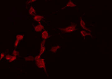 CASP7 / Caspase 7 Antibody - Staining HeLa cells by IF/ICC. The samples were fixed with PFA and permeabilized in 0.1% Triton X-100, then blocked in 10% serum for 45 min at 25°C. The primary antibody was diluted at 1:200 and incubated with the sample for 1 hour at 37°C. An Alexa Fluor 594 conjugated goat anti-rabbit IgG (H+L) Ab, diluted at 1/600, was used as the secondary antibody.