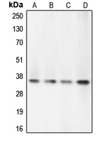 CASP7 / Caspase 7 Antibody - Western blot analysis of Caspase 7 expression in PC12 (A); Jurkat (B); HeLa (C); HEK293T (D) whole cell lysates.