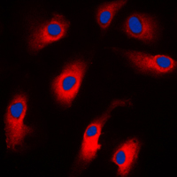 CASP7 / Caspase 7 Antibody - Immunofluorescent analysis of Caspase 7 staining in Jurkat cells. Formalin-fixed cells were permeabilized with 0.1% Triton X-100 in TBS for 5-10 minutes and blocked with 3% BSA-PBS for 30 minutes at room temperature. Cells were probed with the primary antibody in 3% BSA-PBS and incubated overnight at 4 C in a humidified chamber. Cells were washed with PBST and incubated with a DyLight 594-conjugated secondary antibody (red) in PBS at room temperature in the dark. DAPI was used to stain the cell nuclei (blue).