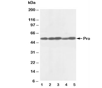 CASP8 / Caspase 8 Antibody - Western blot testing of anti-Caspase-8 antibody and Lane 1: rat thymus; 2: rat liver; 3: MCF-7; 4: HeLa; 5: SMMC-7721