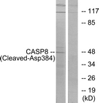 CASP8 / Caspase 8 Antibody - Western blot of extracts from 293 cells, treated with etoposide 25 uM 1h, using Caspase 8 (Cleaved-Asp384) Antibody. The lane on the right is treated with the synthesized peptide.