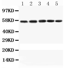 CASP8 / Caspase 8 Antibody - Caspase-8 antibody Western blot. All lanes: Anti Caspase-8 at 0.5 ug/ml. Lane 1: Mouse Spleen Tissue Lysate at 50 ug. Lane 2: Mouse Thymus Tissue Lysate at 50 ug. Lane 3: Mouse Kidney Tissue Lysate at 50 ug. Lane 4: Mouse Lung Tissue Lysate at 50 ug. Lane 5: HEPA Cell Lysate at 40 ug. Predicted band size: 55 kD. Observed band size: 55 kD.