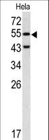 CASP8 / Caspase 8 Antibody - Western blot of CASP8 antibody in HeLa cell line lysates (35 ug/lane). CASP8 (arrow) was detected using the purified antibody.