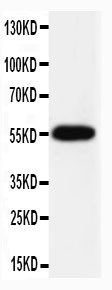 CASP8 / Caspase 8 Antibody - WB of CASP8 / Caspase 8 antibody. All lanes: Anti-CASP8(P10) at 0.5ug/ml. WB: HELA Whole Cell Lysate at 40ug. Predicted bind size: 55KD. Observed bind size: 55KD.