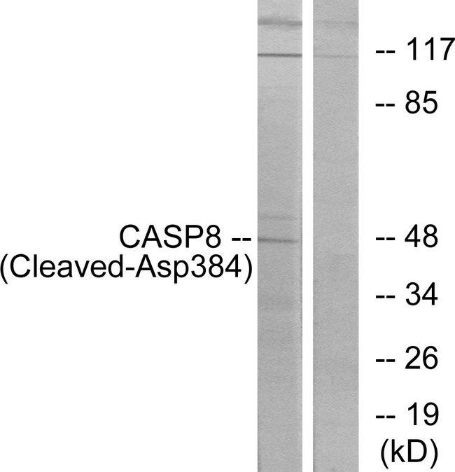 CASP8 / Caspase 8 Antibody - Western blot analysis of extracts from 293 cells, treated with etoposide (25uM, 1hour), using CASP8 (Cleaved-Asp384) antibody.