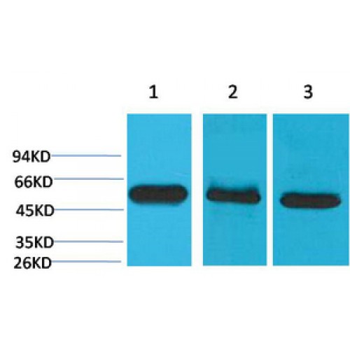 CASP8 / Caspase 8 Antibody - Western blot of Caspase-8 antibody