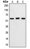 CASP8 / Caspase 8 Antibody - Western blot analysis of Caspase 8 expression in DLD (A); mouse liver (B); Raw264.7 (C) whole cell lysates.