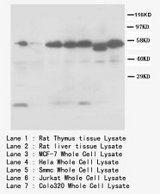 CASP8 / Caspase 8 Antibody -  This image was taken for the unconjugated form of this product. Other forms have not been tested.