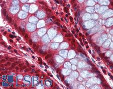 CASP8 / Caspase 8 Antibody - Anti-Caspase 8 antibody IHC of human colon. Immunohistochemistry of formalin-fixed, paraffin-embedded tissue after heat-induced antigen retrieval. Antibody concentration 5 ug/ml.