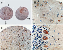 CASP8 / Caspase 8 Antibody - Formalin-fixed, paraffin-embedded sections from a brain tissue array stained for Caspase-8 expression using Polyclonal Antibody to Active/Cleaved Caspase-8 at 1:2000. A. Normal brain stem (1) and cortex (2). B. Higher magnification of cortex (from A). C. Higher magnification of brain stem (from A). D. Normal cerebellum showing caspase-8 staining in the Purkinje cells.