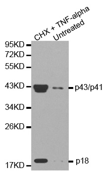 CASP8 / Caspase 8 Antibody - Western blot analysis of HeLa cells treated with cycloheximide (CHX) and TNF-alpha.