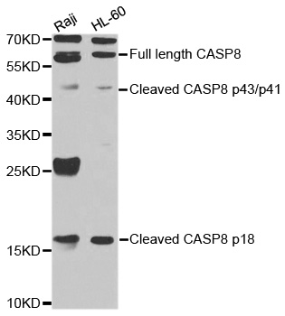 CASP8 / Caspase 8 Antibody - Western blot analysis of extracts of various cell lines, using CASP8 antibody at 1:1000 dilution. The secondary antibody used was an HRP Goat Anti-Rabbit IgG (H+L) at 1:10000 dilution. Lysates were loaded 25ug per lane and 3% nonfat dry milk in TBST was used for blocking. An ECL Kit was used for detection and the exposure time was 30s.