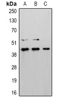 CASP8 / Caspase 8 Antibody - Western blot analysis of Caspase 8 expression in HeLa (A); Raw264.7 (B); PC12 (C) whole cell lysates.