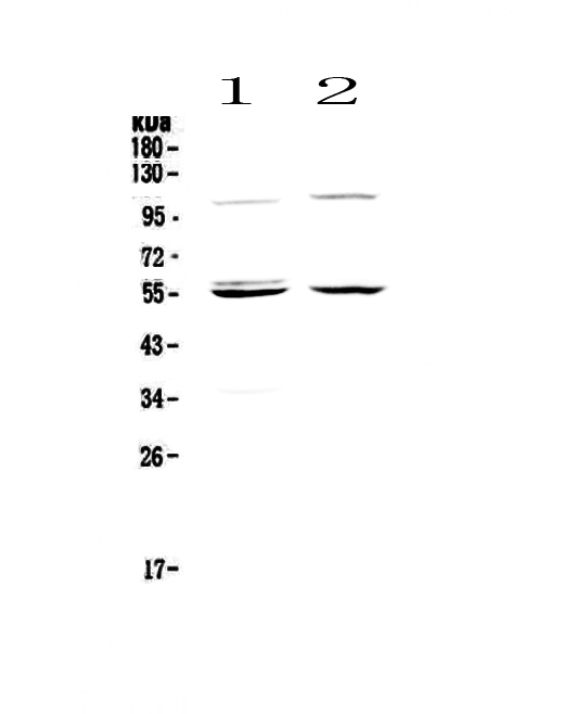 CASP8 / Caspase 8 Antibody - Western blot - Anti-Caspase 8 Picoband antibody