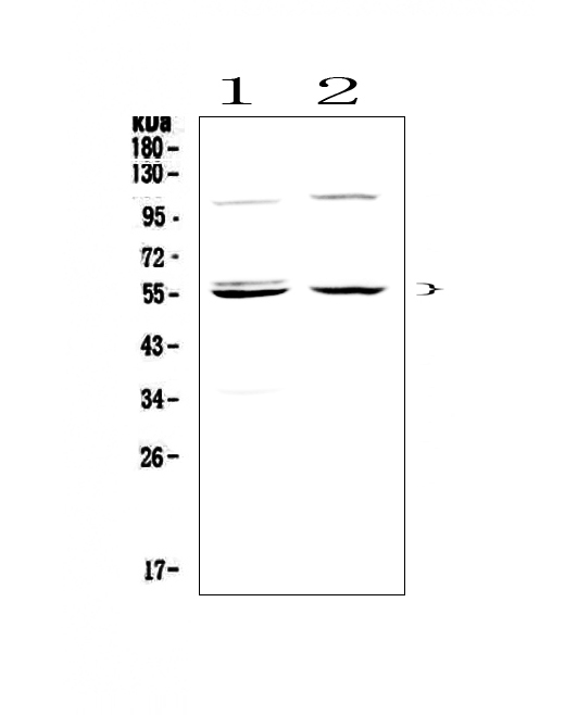 CASP8 / Caspase 8 Antibody - Western blot analysis of Caspase 8 using anti-Caspase 8 antibody. Electrophoresis was performed on a 5-20% SDS-PAGE gel at 70V (Stacking gel) / 90V (Resolving gel) for 2-3 hours. The sample well of each lane was loaded with 50ug of sample under reducing conditions. Lane 1: human Hela whole cell lysates, Lane 2: human SGC-7901 whole cell lysates. After Electrophoresis, proteins were transferred to a Nitrocellulose membrane at 150mA for 50-90 minutes. Blocked the membrane with 5% Non-fat Milk/ TBS for 1.5 hour at RT. The membrane was incubated with rabbit anti-Caspase 8 antigen affinity purified polyclonal antibody at 0.5 µg/mL overnight at 4°C, then washed with TBS-0.1% Tween 3 times with 5 minutes each and probed with a goat anti-rabbit IgG-HRP secondary antibody at a dilution of 1:10000 for 1.5 hour at RT. The signal is developed using an Enhanced Chemiluminescent detection (ECL) kit with Tanon 5200 system. A specific band was detected for Caspase 8 at approximately 55KD. The expected band size for Caspase 8 is at 55KD.