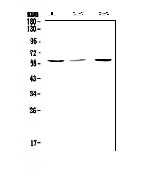 CASP8 / Caspase 8 Antibody - Western blot analysis of Caspase 8 using anti-Caspase 8 antibody. Electrophoresis was performed on a 5-20% SDS-PAGE gel at 70V (Stacking gel) / 90V (Resolving gel) for 2-3 hours. The sample well of each lane was loaded with 50ug of sample under reducing conditions. Lane 1: rat thymus tissue lysates, Lane 2: mouse spleen tissue lysates, Lane 3: mouse thymus tissue lysates. After Electrophoresis, proteins were transferred to a Nitrocellulose membrane at 150mA for 50-90 minutes. Blocked the membrane with 5% Non-fat Milk/ TBS for 1.5 hour at RT. The membrane was incubated with rabbit anti-Caspase 8 antigen affinity purified polyclonal antibody at 0.5 µg/mL overnight at 4°C, then washed with TBS-0.1% Tween 3 times with 5 minutes each and probed with a goat anti-rabbit IgG-HRP secondary antibody at a dilution of 1:10000 for 1.5 hour at RT. The signal is developed using an Enhanced Chemiluminescent detection (ECL) kit with Tanon 5200 system. A specific band was detected for Caspase 8 at approximately 55-60KD. The expected band size for Caspase 8 is at 55KD.
