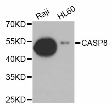 CASP8 / Caspase 8 Antibody - Western blot analysis of extracts of various cell lines, using CASP8 antibody at 1:1000 dilution. The secondary antibody used was an HRP Goat Anti-Rabbit IgG (H+L) at 1:10000 dilution. Lysates were loaded 25ug per lane and 3% nonfat dry milk in TBST was used for blocking. An ECL Kit was used for detection and the exposure time was 90s.