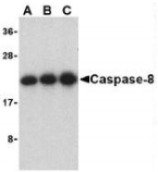 CASP8 / Caspase 8 Antibody - Western blot analysis of Caspase-8 in Jurkat cell lysate with Caspase-8 antibody at (A) 0.5, (B) 1, and (C) 2µg/ml.