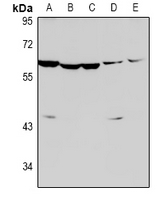 CASP8 / Caspase 8 Antibody - Western blot analysis of Caspase 8 expression in K562 (A), HepG2 (B), A549 (C), H9C2 (D), MEF (E) whole cell lysates.