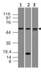 CASP8 / Caspase 8 Antibody - Fig-1: Western blot analysis of Caspase-8. Anti-Caspase-8 antibody was used at 2 µg/ml on Molt-4, Kato III and HepG2 lysates.