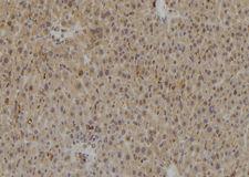 CASP8 / Caspase 8 Antibody - 1:100 staining rat liver tissue by IHC-P. The sample was formaldehyde fixed and a heat mediated antigen retrieval step in citrate buffer was performed. The sample was then blocked and incubated with the antibody for 1.5 hours at 22°C. An HRP conjugated goat anti-rabbit antibody was used as the secondary.
