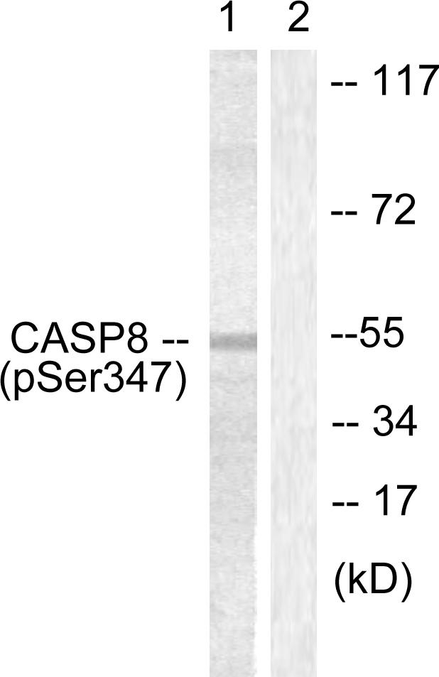 CASP8 / Caspase 8 Antibody - Western blot analysis of lysates from Jurkat cells, using Caspase 8 (Phospho-Ser347) Antibody. The lane on the right is blocked with the phospho peptide.