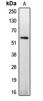 CASP8 / Caspase 8 Antibody - Western blot analysis of Caspase 8 (pS347) expression in Jurkat PMA-treated (A) whole cell lysates.