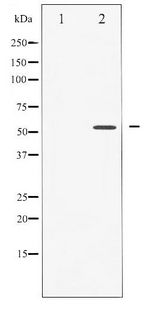 CASP8 / Caspase 8 Antibody - Western blot of Caspase 8 phosphorylation expression in Jurkat whole cell lysates,The lane on the left is treated with the antigen-specific peptide.