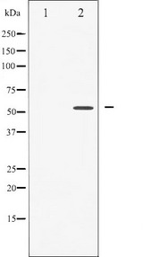 CASP8 / Caspase 8 Antibody - Western blot analysis of Caspase 8 phosphorylation expression in Jurkat whole cells lysates. The lane on the left is treated with the antigen-specific peptide.