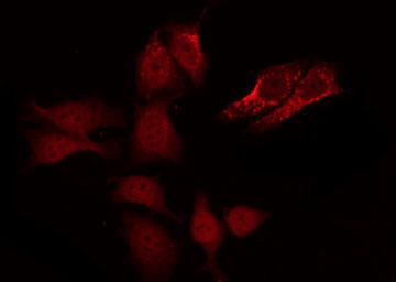 CASP8 / Caspase 8 Antibody - Staining HeLa cells by IF/ICC. The samples were fixed with PFA and permeabilized in 0.1% Triton X-100, then blocked in 10% serum for 45 min at 25°C. The primary antibody was diluted at 1:200 and incubated with the sample for 1 hour at 37°C. An Alexa Fluor 594 conjugated goat anti-rabbit IgG (H+L) Ab, diluted at 1/600, was used as the secondary antibody.