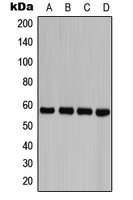 CASP8 / Caspase 8 Antibody - Western blot analysis of Caspase 8 (pY380) expression in HEK293T PMA-treated (A); Jurkat etoposide-treated (B); HeLa PMA-treated (C); H9C2 PMA-treated (D) whole cell lysates.