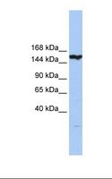 CASP8AP2 / FLASH Antibody - Hela cell lysate. Antibody concentration: 1.0 ug/ml. Gel concentration: 6%-18%.  This image was taken for the unconjugated form of this product. Other forms have not been tested.
