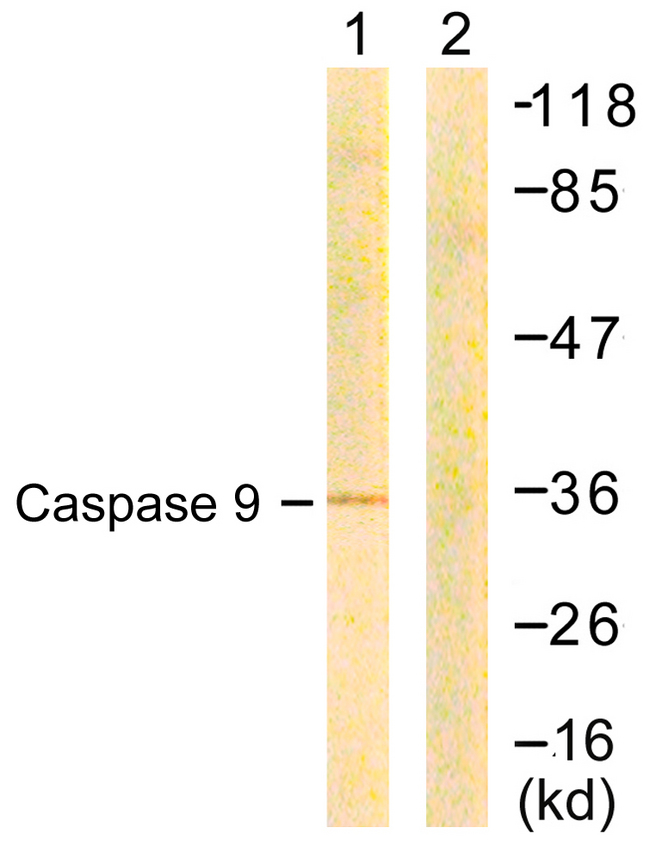 CASP9 / Caspase 9 Antibody - Western blot analysis of lysates from COS7 cells, treated with Etoposide 25uM 24h, using Caspase 9 Antibody. The lane on the right is blocked with the synthesized peptide.