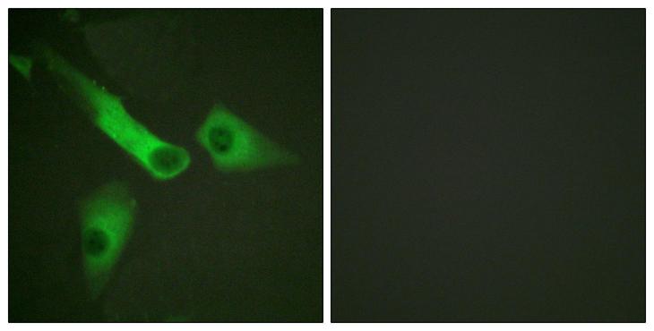 CASP9 / Caspase 9 Antibody - Immunofluorescence analysis of HeLa cells, using Caspase 9 Antibody. The picture on the right is blocked with the synthesized peptide.