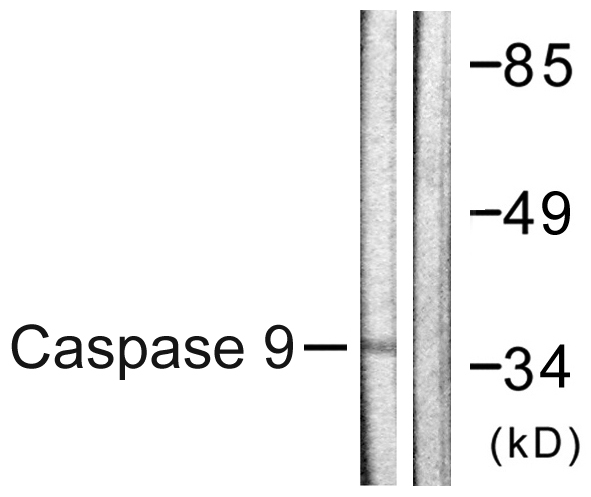 CASP9 / Caspase 9 Antibody - Western blot analysis of lysates from HeLa cells, treated with EGF 200ng/ml 30', using Caspase 9 Antibody. The lane on the right is blocked with the synthesized peptide.