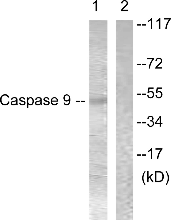 CASP9 / Caspase 9 Antibody - Western blot analysis of lysates from 293 cells, treated with Calyculin 50nM 30', using Caspase 9 Antibody. The lane on the right is blocked with the synthesized peptide.