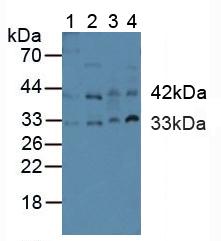 CASP9 / Caspase 9 Antibody - Western Blot; Sample: Lane1: Human Placenta Tissue; Lane2: Human Hela Cells; Lane3: Rat Heart Tissue; Lane4: Rat Uterus Tissue.
