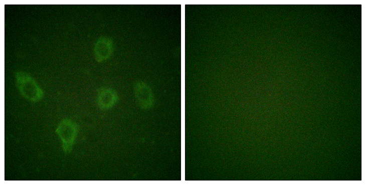 CASP9 / Caspase 9 Antibody - Immunofluorescence analysis of HUVEC cells, using Caspase 9 Antibody. The picture on the right is blocked with the synthesized peptide.