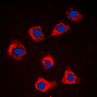 CASP9 / Caspase 9 Antibody - Immunofluorescent analysis of Caspase 9 staining in NIH3T3 cells. Formalin-fixed cells were permeabilized with 0.1% Triton X-100 in TBS for 5-10 minutes and blocked with 3% BSA-PBS for 30 minutes at room temperature. Cells were probed with the primary antibody in 3% BSA-PBS and incubated overnight at 4 C in a humidified chamber. Cells were washed with PBST and incubated with a DyLight 594-conjugated secondary antibody (red) in PBS at room temperature in the dark. DAPI was used to stain the cell nuclei (blue).
