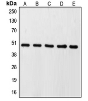 CASP9 / Caspase 9 Antibody - Western blot analysis of Caspase 9 expression in HeLa (A); HEK293T (B); SP2/0 (C); mouse kidney (D); rat lung (E) whole cell lysates.