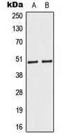 CASP9 / Caspase 9 Antibody - Western blot analysis of Caspase 9 expression in HeLa (A); Jurkat (B) whole cell lysates.