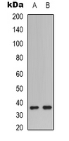 CASP9 / Caspase 9 Antibody - Western blot analysis of Caspase 9 p35 expression in A549 (A); HEK293T (B) whole cell lysates.