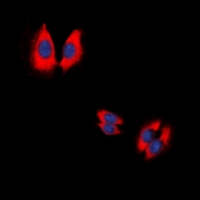 CASP9 / Caspase 9 Antibody - Immunofluorescent analysis of Caspase 9 p35 staining in HeLa cells. Formalin-fixed cells were permeabilized with 0.1% Triton X-100 in TBS for 5-10 minutes and blocked with 3% BSA-PBS for 30 minutes at room temperature. Cells were probed with the primary antibody in 3% BSA-PBS and incubated overnight at 4 deg C in a humidified chamber. Cells were washed with PBST and incubated with a DyLight 594-conjugated secondary antibody (red) in PBS at room temperature in the dark. DAPI was used to stain the cell nuclei (blue).