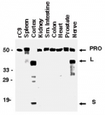 CASP9 / Caspase 9 Antibody - Western blot of Caspase-9. Various tissue lysates were prepared from human autopsy material and normalized for total protein. Most tissues contained the ~50 kD pro-Caspase-9 protein. Cleaved Caspase-9 was identified in brain cortex and peripheral nerve tissue samples. Pro-C9: recombinant human pro-Caspase-9 (full-length) protein. PRO: pro-Caspase-9. L: large subunit of cleaved Caspase-9. S: small subunit of cleaved Caspase-9.