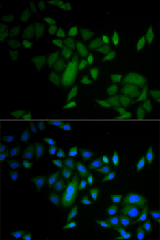 CASP9 / Caspase 9 Antibody - Immunofluorescence analysis of A549 cells.