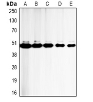 CASP9 / Caspase 9 Antibody - Western blot analysis of Caspase 9 expression in HeLa (A); Jurkat (B); HepG2 (C); mouse heart (D); rat heart (E) whole cell lysates.