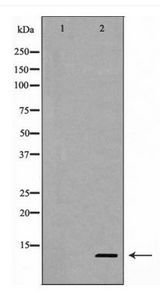 CASP9 / Caspase 9 Antibody - Western blot of Caspase 9 (Cleaved-Asp353) expression in NIH/3T3 cells treated with etoposide