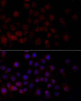 CASP9 / Caspase 9 Antibody - Immunofluorescence analysis of HeLa cells using CASP9 antibodyat dilution of 1:100 (40x lens). Blue: DAPI for nuclear staining.