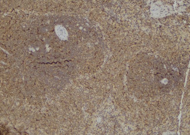 CASP9 / Caspase 9 Antibody - 1:100 staining rat spleen tissue by IHC-P. The sample was formaldehyde fixed and a heat mediated antigen retrieval step in citrate buffer was performed. The sample was then blocked and incubated with the antibody for 1.5 hours at 22°C. An HRP conjugated goat anti-rabbit antibody was used as the secondary.