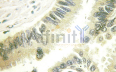 CASP9 / Caspase 9 Antibody - 1/100 staining human colon  tissue by IHC-P. The sample was formaldehyde fixed and a heat mediated antigen retrieval step in citrate buffer was performed. The sample was then blocked and incubated with the antibody for 1.5 hours at 22°C. An HRP conjugated goat anti-rabbit antibody was used as the secondary antibody.